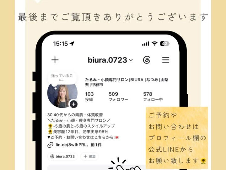 リフトアップしたい